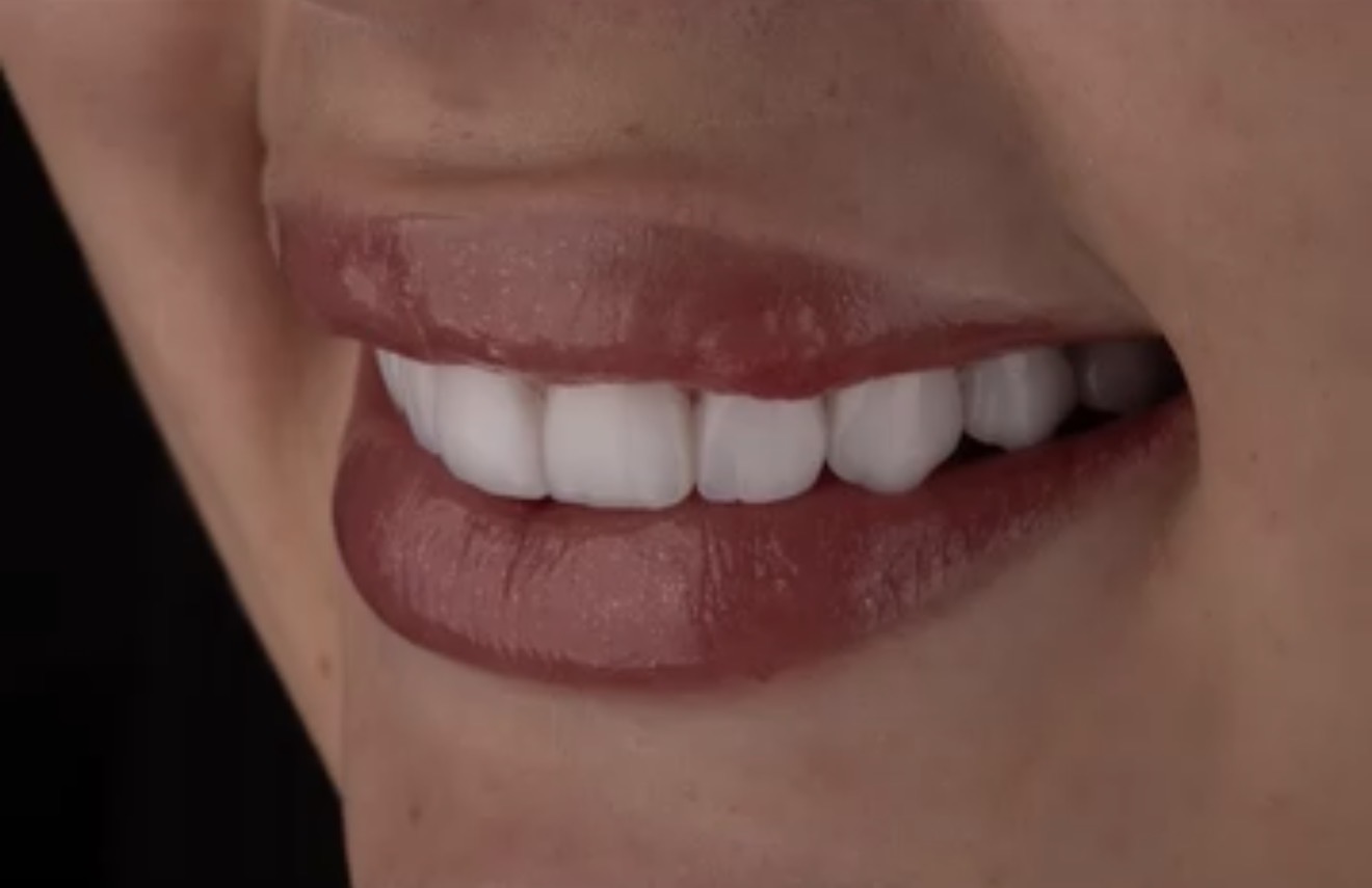 Resultado de sorriso 2